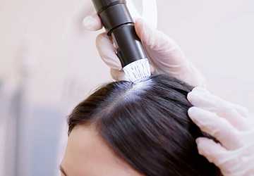 The New Age of Hair Care: Scalp Treatments for Healthy Growth